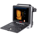 UW-P6 Portable Color Doppler 4D Ultrasound scanner